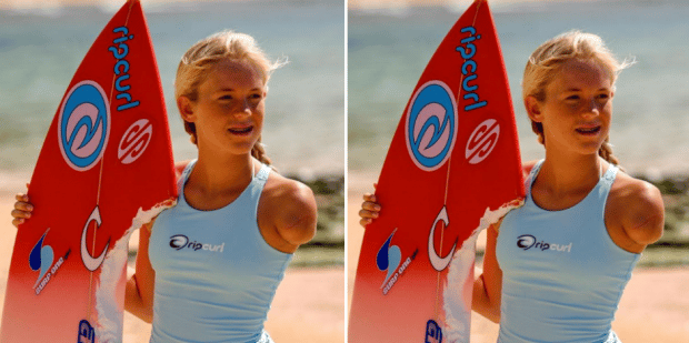 Did they ever find Bethany Hamilton's arm?
